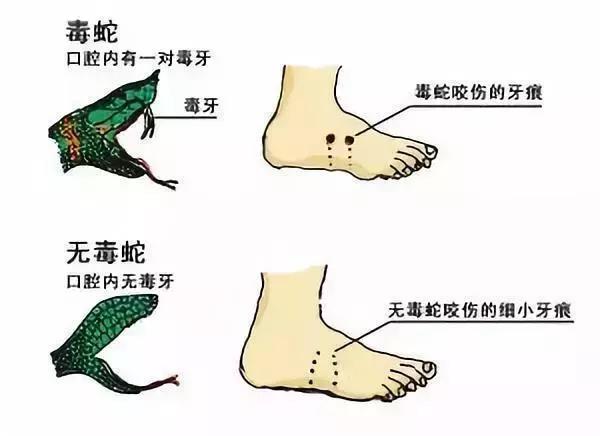 2025新澳门正版免费挂牌和女子遭毒蛇咬伤身亡与女子遭毒蛇咬伤身亡视频