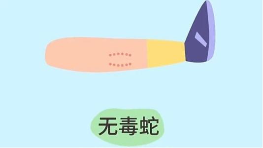 2025新澳门正版免费挂牌和被蛇咬反抓蛇再遭咬与被蛇咬反抓蛇再遭咬伤